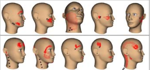 IRRADIAZIONE ATM
